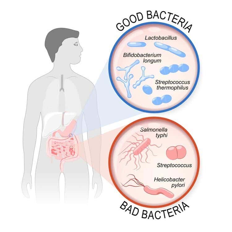 good and bad probiotics good and bad probiotics